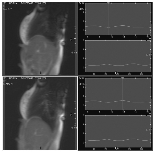 fig1a