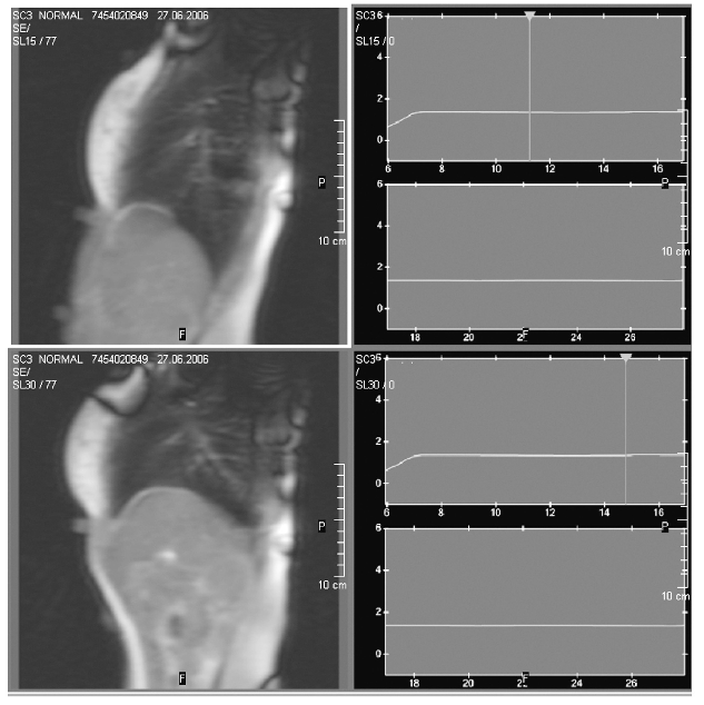 fig1b