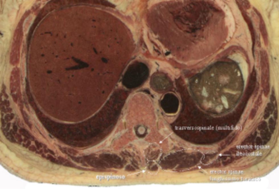 fig31